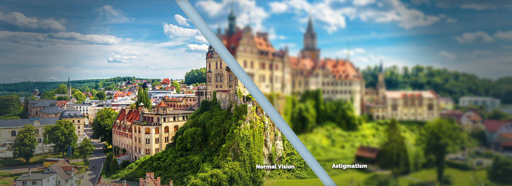 Astigmatism Treatment in Girard