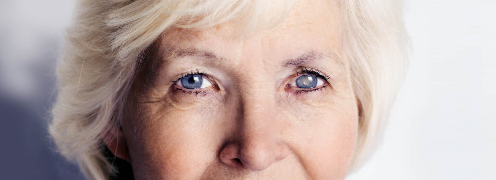 Cataract Surgery in Girard
