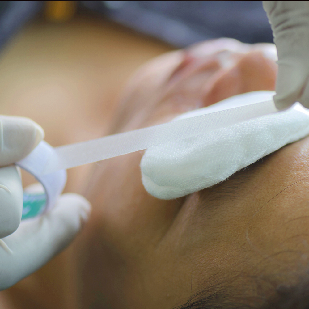 eye emergency treated at Sforza EyeCare